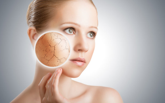Las 5 causas de la piel sensible y cómo combatirlas